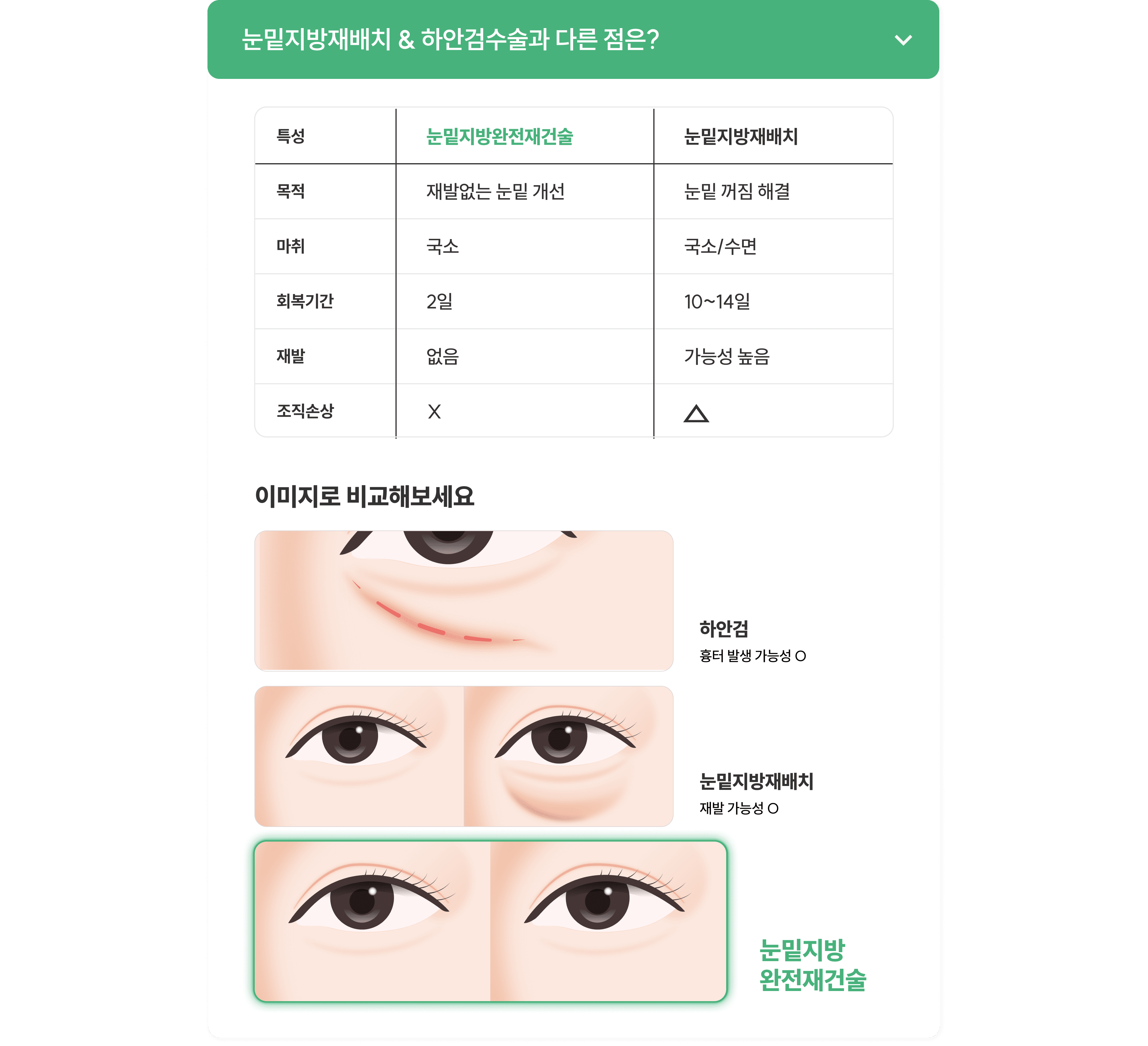 눈밑지방재배치청담EL