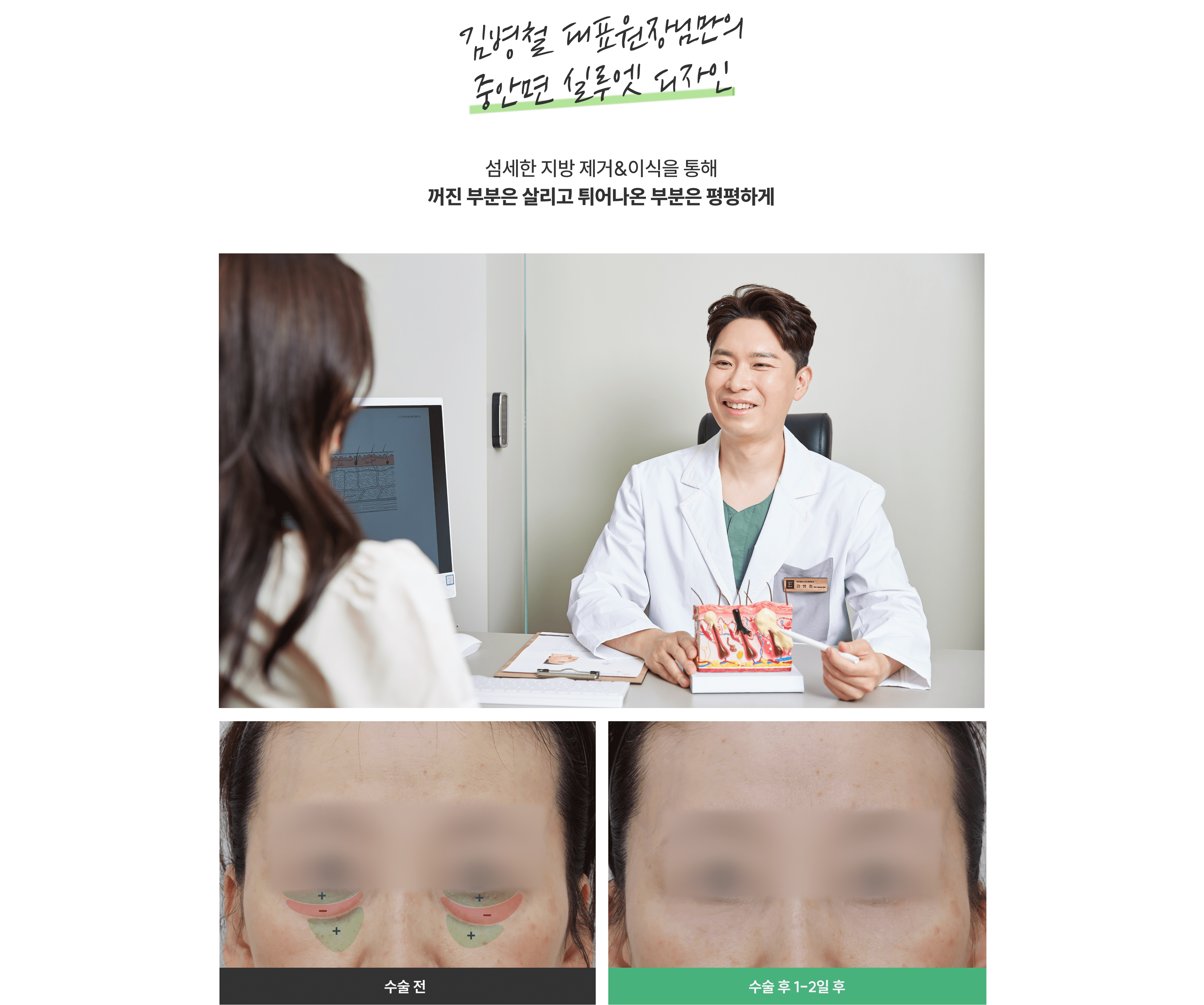눈밑지방재배치청담EL